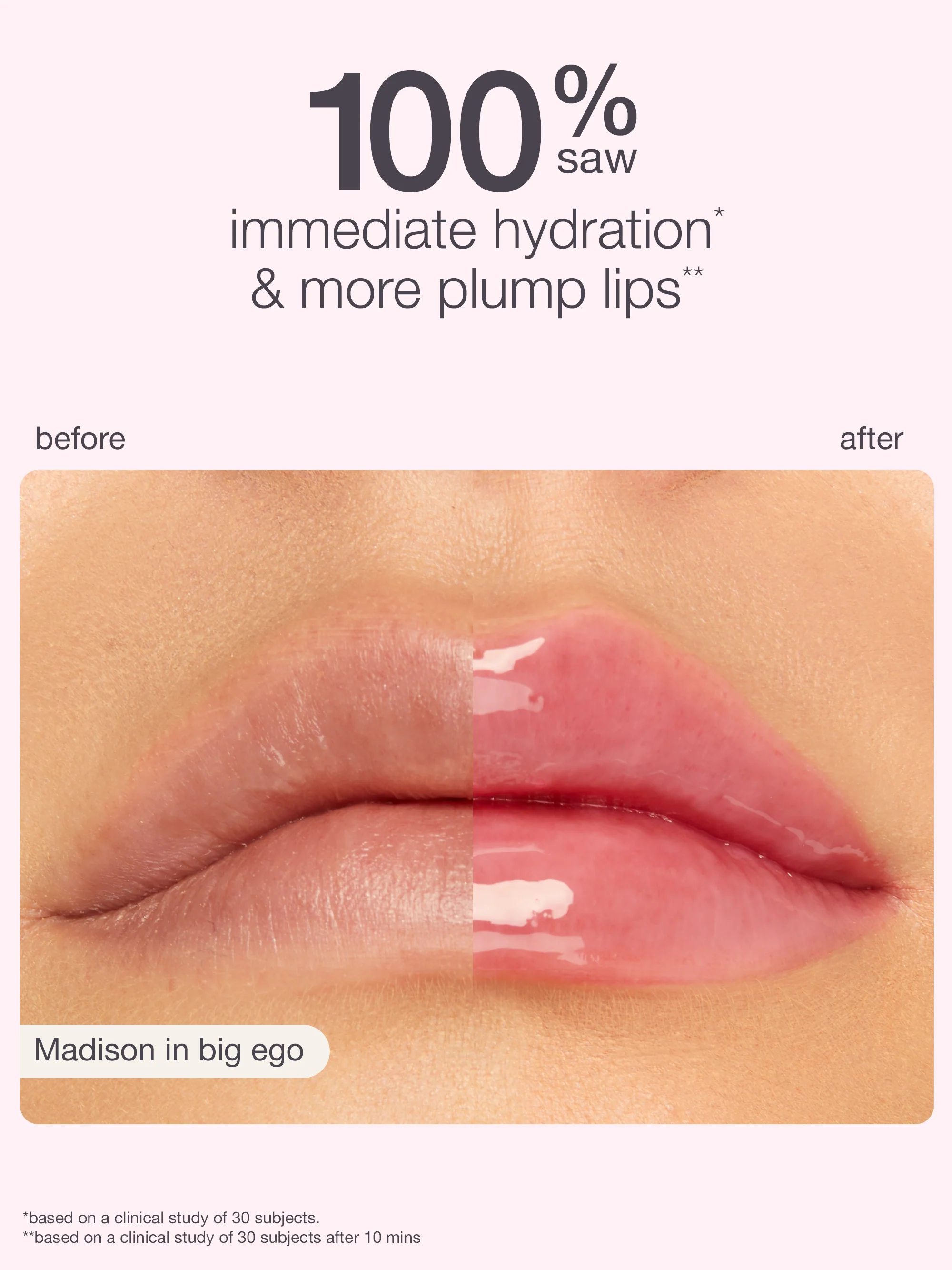 limited-edition maracuja juicy shift - Image 3
