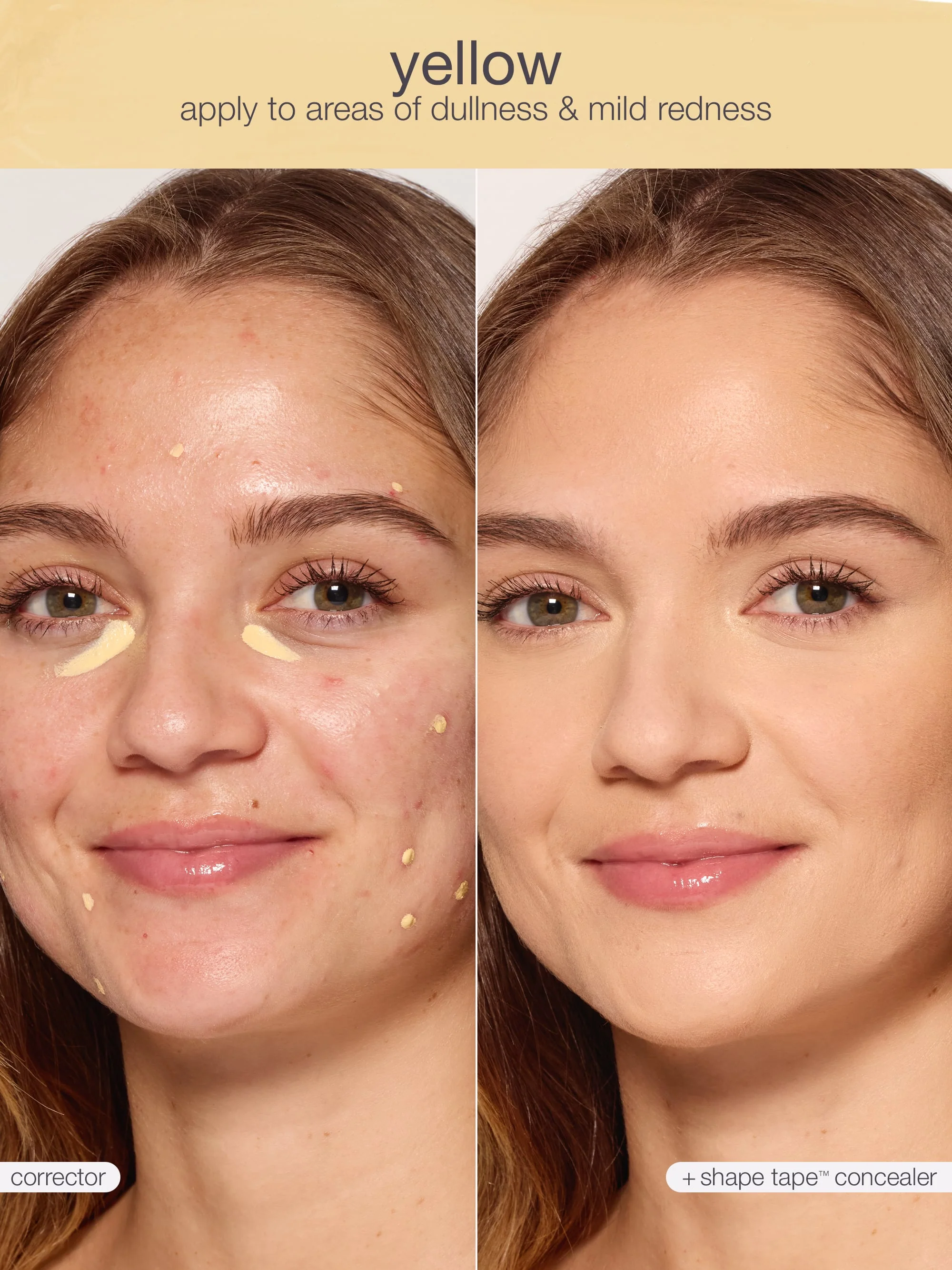 shape tape™ corrector - Image 23