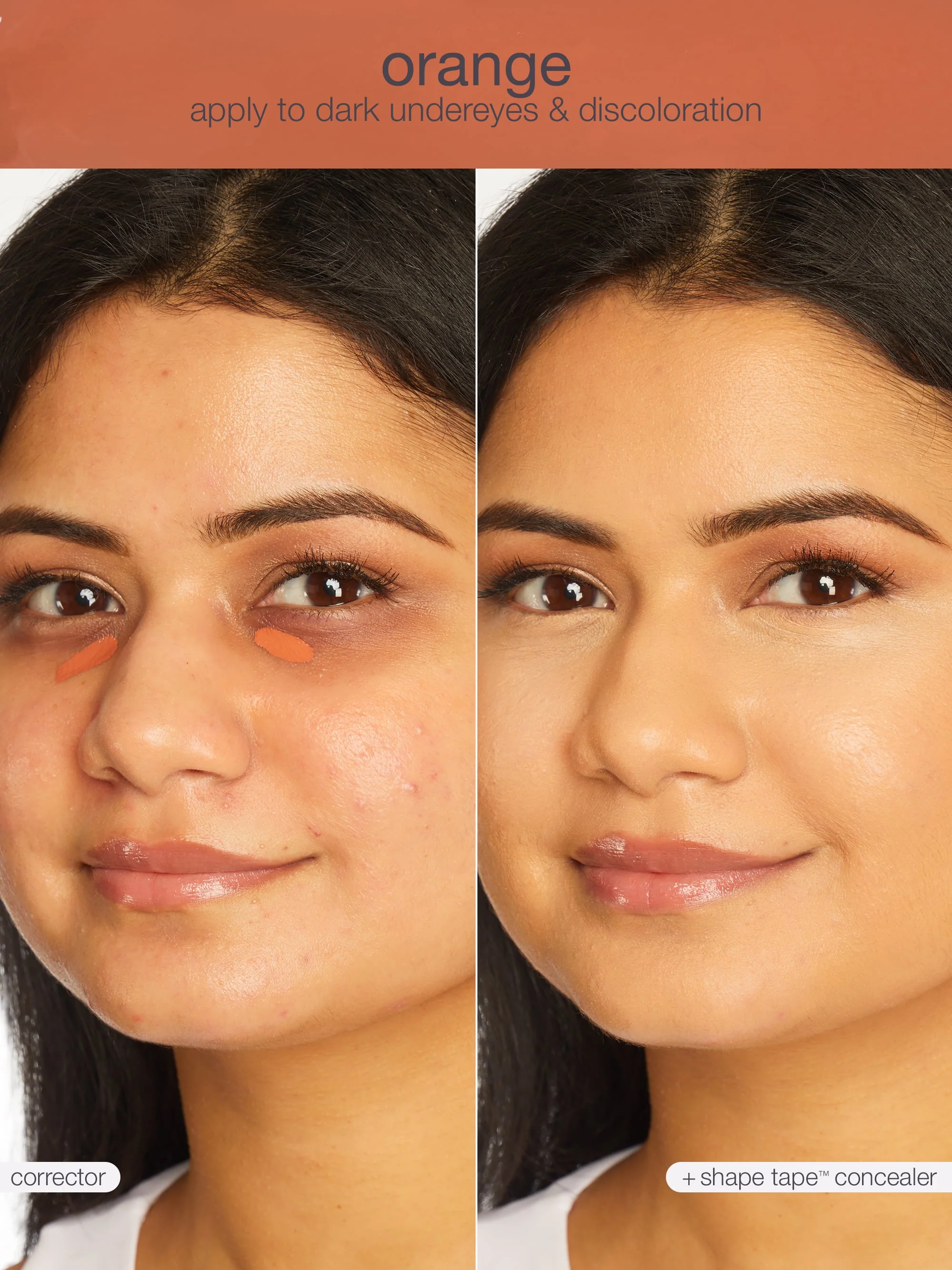 shape tape™ corrector - Image 25