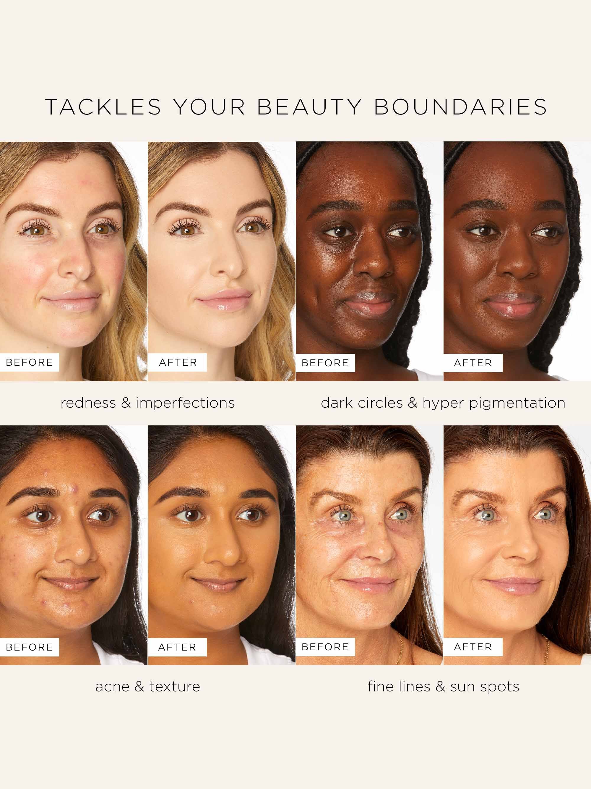 skin treat poreless foundation stick - Image 3